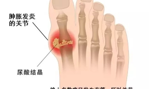 痹痛宁能长期吃吗-权威痹痛宁胶囊吃几天停药平台,分享专业痹痛宁胶囊能长期服用吗?知识_痹痛宁胶囊能长期服用网